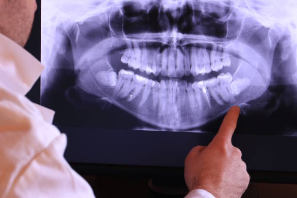 Best Urgent Dental Care for Toothache in Chelsea, AL